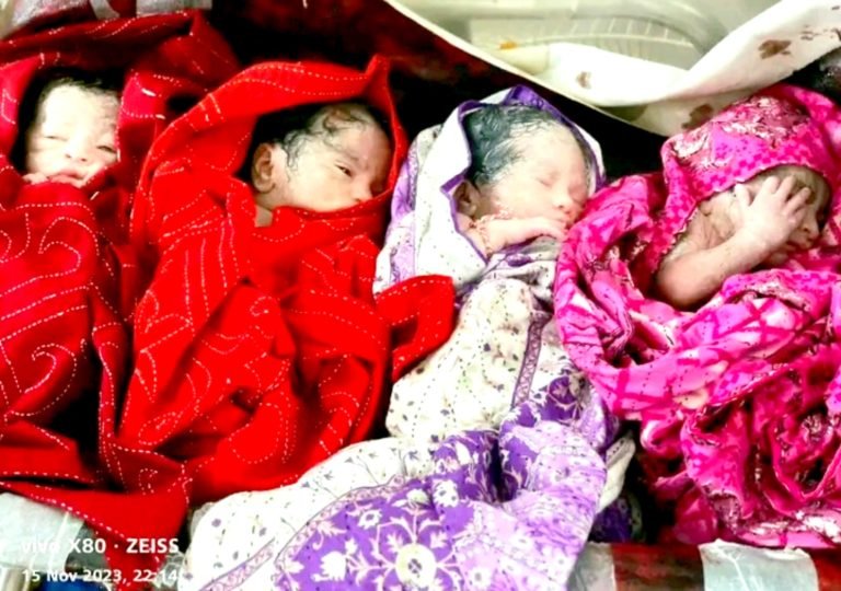 পটুয়াখালীতে এক সাথে ৪ সন্তানের জম্ম