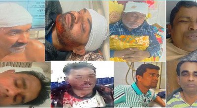 পরিকল্পিতভাবে পুরাতন মোটরসাইকেলে অগ্নিসংযোগ করা হয়: আ.লীগ