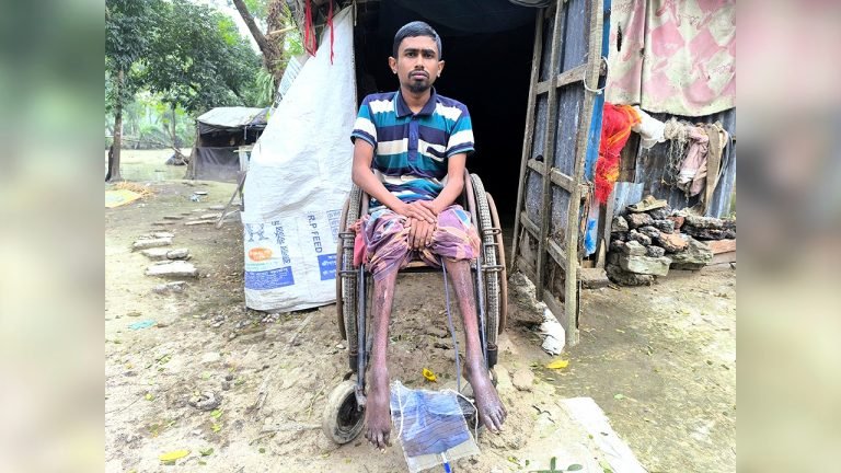 বাউফলের আসলামের বাঁচার আকুতি