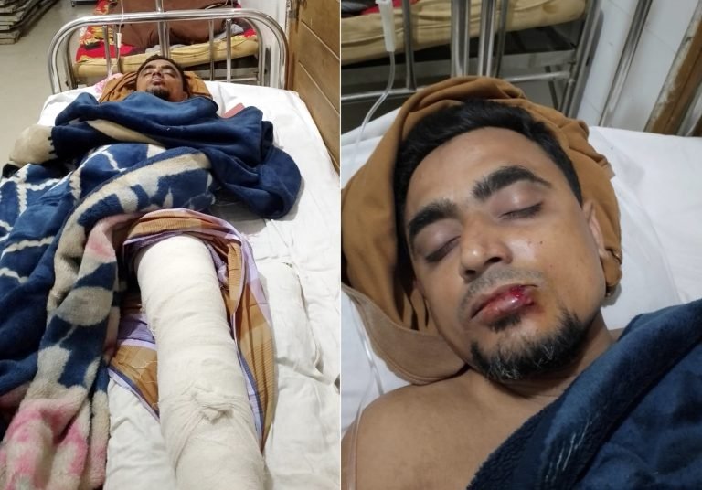 বরিশালে যুবলীগ নেতার পা ভেঙ্গে দিয়েছে ছাত্রলীগ