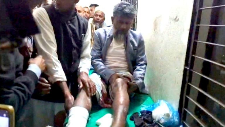 কুয়াকাটায়  ইউপি চেয়ারম্যানকে হাতুড়িপেটা