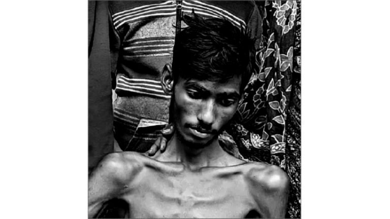 জুয়েলকে সুস্থ করতে আর্থিক সাহাযের প্রয়োজন