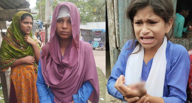 মির্জাগঞ্জে হনুমানের আক্রমণে ২ স্কুলছাত্রী আহত