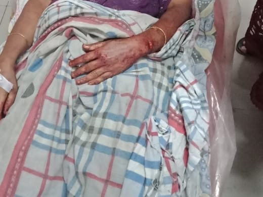 আমতলীতে নেশার টাকা না পেয়ে স্ত্রীর পেটের ভূরি বের করলো স্বামী !