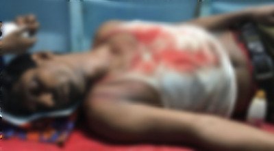 বাউফলে নির্বাচনী সহিংসতায় ইউপি সদস্যসহ আহত ২
