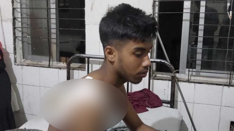 পটুয়াখালীতে ২ জনকে কুপিয়েছে কিশোর গ্যাং ‘কমরেড’ বাহিনী