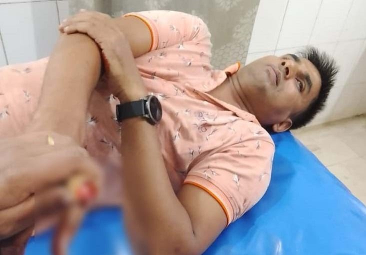 পটুয়াখালীতে সালিশে এক কামড়ে আঙুল নিয়ে পলায়ন