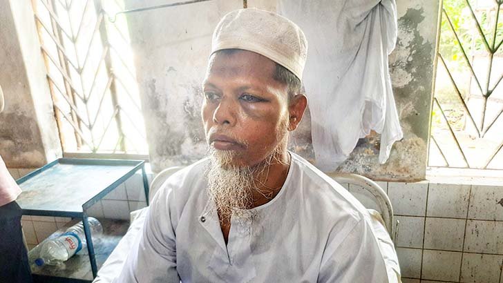 দুমকিতে মেয়েকে শ্লীলতাহানির প্রতিবাদ করায় বাবাকে মারধর