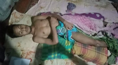 হচ্ছে না চিকিৎসা, পিরোজপুরে বাড়িতে কাতরাচ্ছেন গুলিবিদ্ধ নাঈম