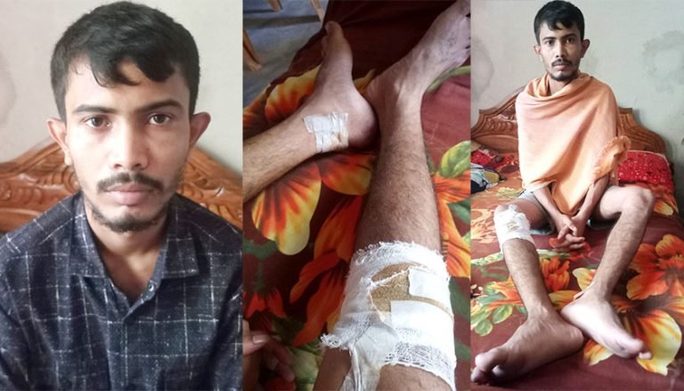বিছানায় কাতরাচ্ছেন বৈষম্য বিরোধী আন্দোলনে গু*লিবিদ্ধ বেল্লাল