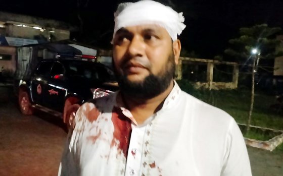ছিনতাইকারীদের কবলে সাংবাদিক: কুপিয়ে জখম