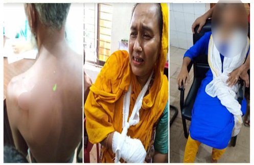 বাউফলে গরুর ঘাস খাওয়া নিয়ে মারামারি – আহত ৫