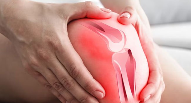 অস্টিওপোরোসিস: ‘নীরব’ ঘাতকের ক্ষতি এবং প্রতিকার