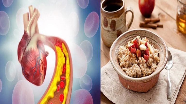 কোলেস্টেরল নিয়ন্ত্রণে সহায়তা করে ৩ খাদ্য