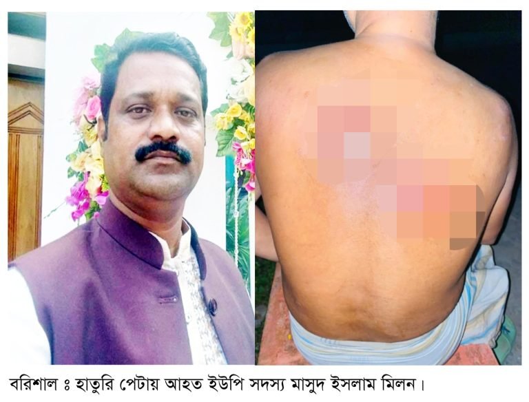 বরিশালে ইউপি সদস্যকে হাতুরি পেটা
