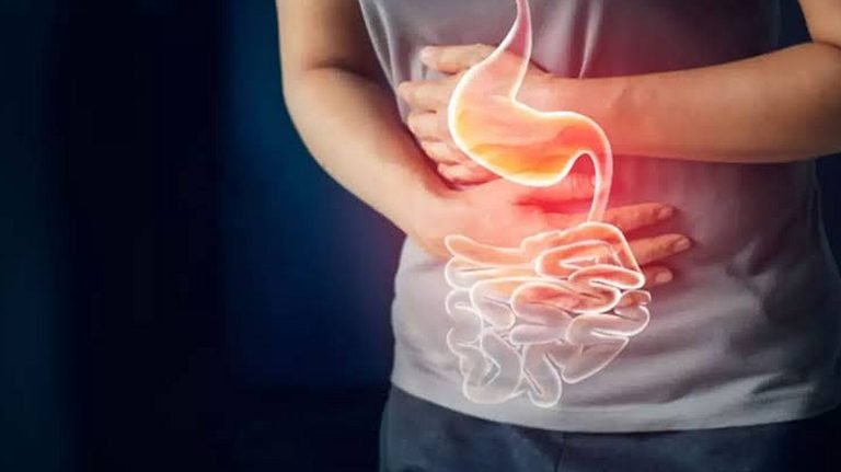 গ্যাস্ট্রিক সমস্যা: কারণ, প্রতিকার, এবং প্রতিরোধের উপায়