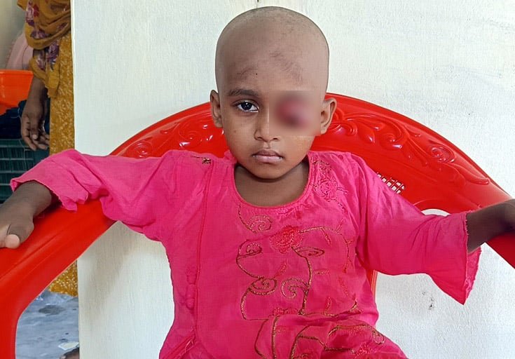 কলাপাড়ায় ক্যানসারে আক্রান্ত শিশু জামিলা বাঁচতে চায়