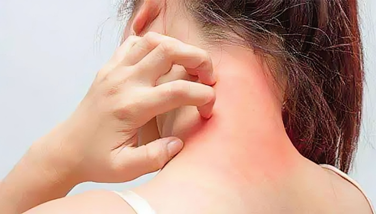 শীতের দিনে ত্বক সুস্থ রাখতে যা করবেন