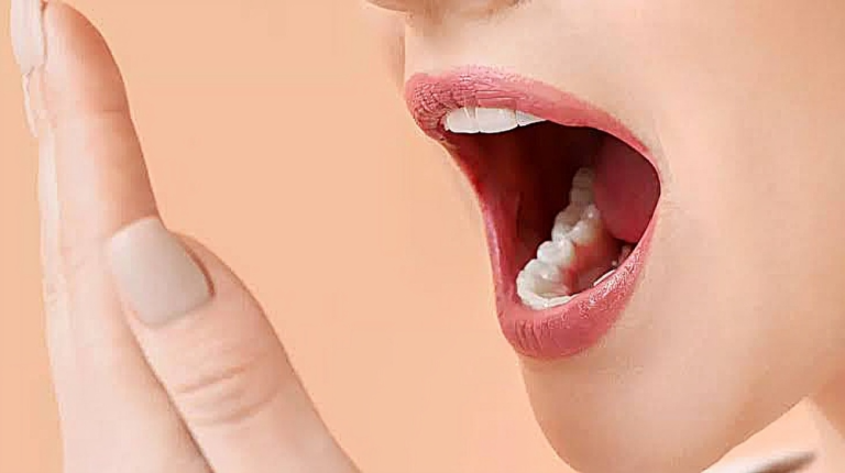 লবঙ্গ: মুখের দুর্গন্ধ ও মাড়ির সমস্যার প্রাকৃতিক সমাধান