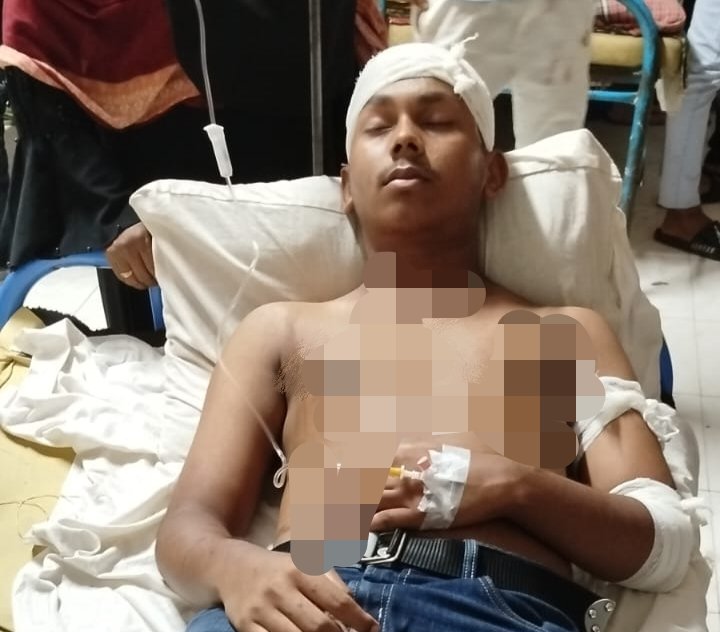 বরিশালের কাজির হাট কিশোর গ্যাংয়ের হামলায় আহত ১