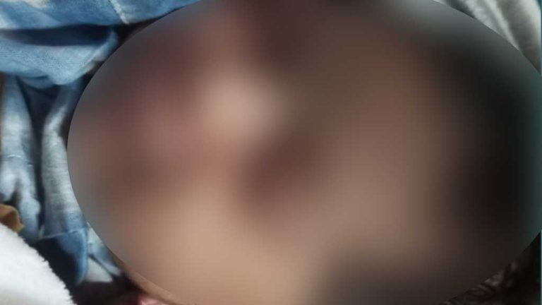 বরিশালে নদীতে ফেলে দেওয়ার ৫ দিন পর মিলল নবজাতকের লাশ
