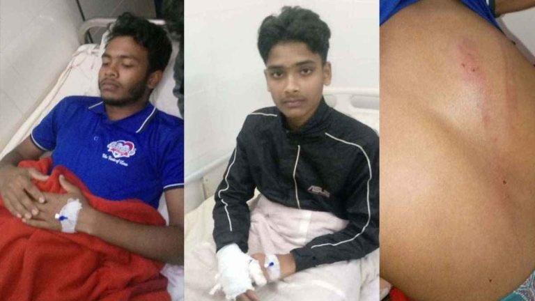 পিরোজপুরে ‘ছাত্রলীগের’ হামলায় ৩ শিবির কর্মী আহত