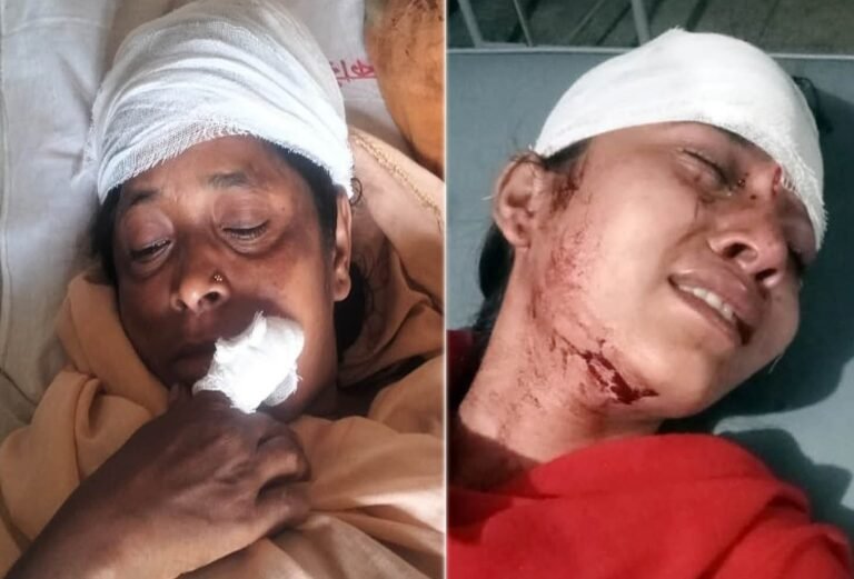 বরিশালে মা ও মেয়েকে কুপিয়ে জখমের অভিযোগ