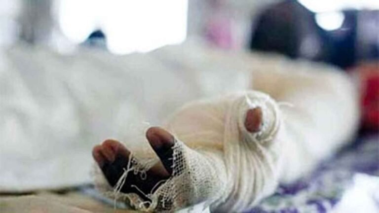 হাজারীবাগে পানির ট্যাংকি পরিষ্কারের সময় বিস্ফোরণ, শিশুসহ দগ্ধ ৪