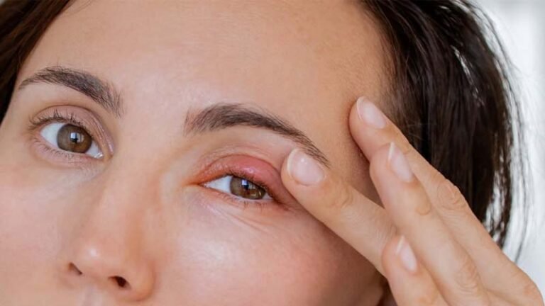 বর্ষায় চোখের সংক্রমণ: সতর্ক থাকুন, উপদেশ দিলেন চক্ষু বিশেষজ্ঞ