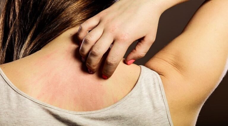 ভিটামিন ডি’র ঘাটতিতে শরীরে দেখা দিতে পারে যেসব উপসর্গ