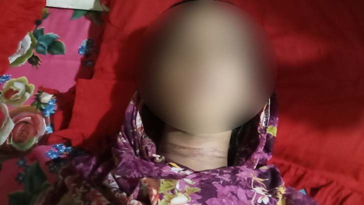 বরগুনায় ধর্ষণে ব্যর্থ হয়ে প্রবাসীর স্ত্রীকে হত্যার চেষ্টা, দেবরসহ দুইজনের বিরুদ্ধে মামলা