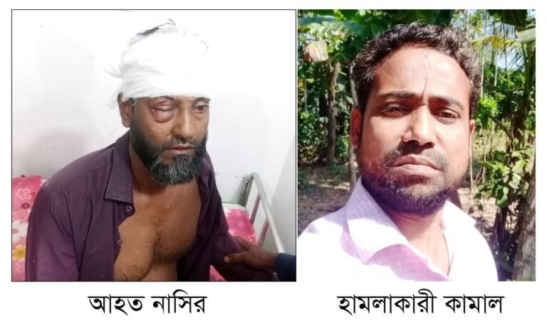 স্বামী-স্ত্রীকে পিটিয়ে জখম : থানায় অভিযোগ