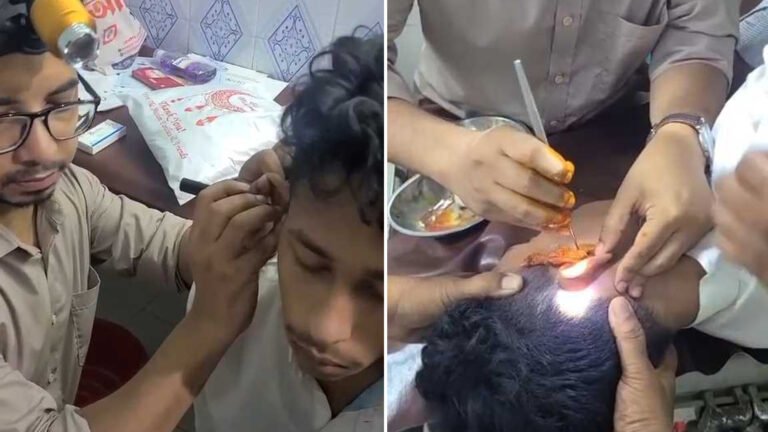 কানে লুকানো ইয়াবা, ৯ দিন পর অস্ত্রোপচার